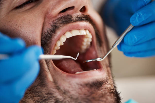 Best Emergency Treatment for Toothache in Park Hill, OK