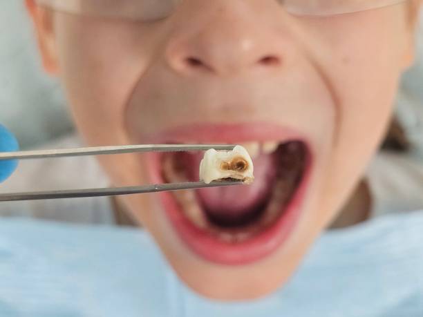 Best Emergency Treatment for Toothache in Park Hill, OK